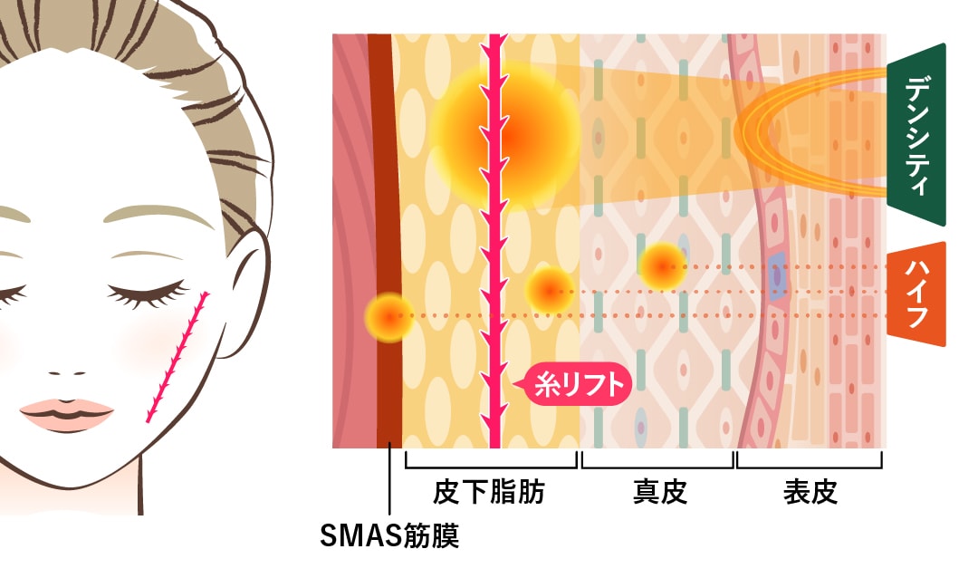 狙う層とアプローチ方法の違い