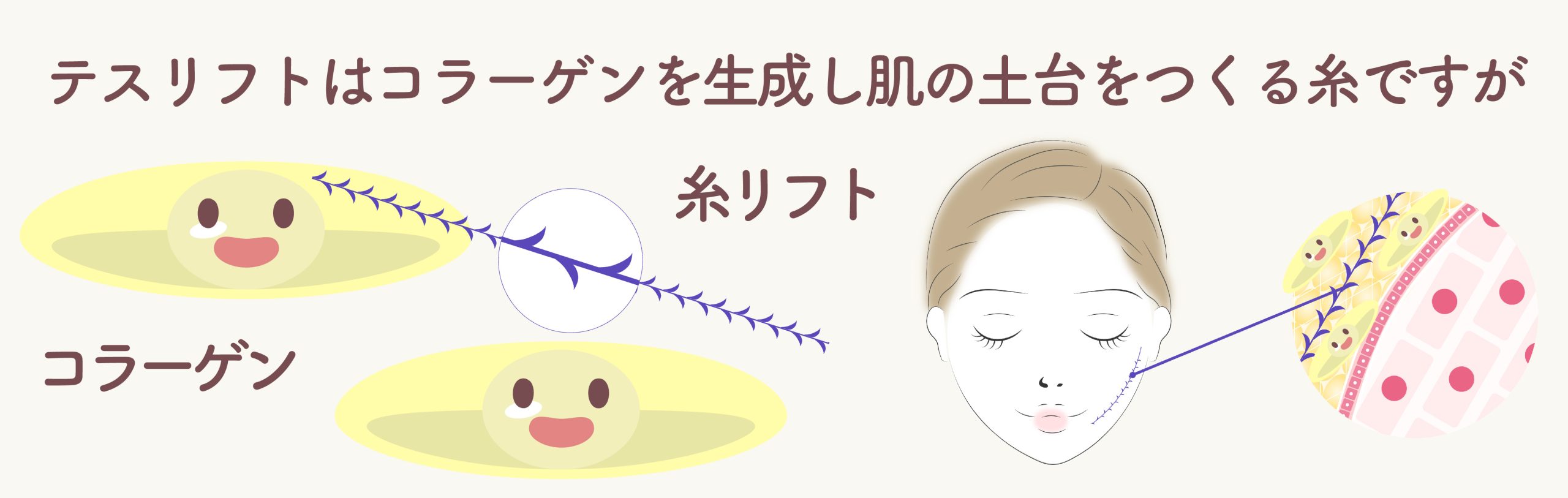 糸リフトと肌育注射を組み合わせがおすすめな理由①