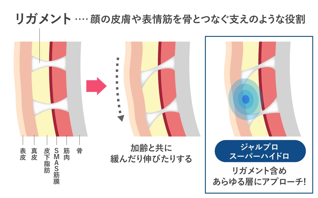 肌を支える靭帯「リガメント」