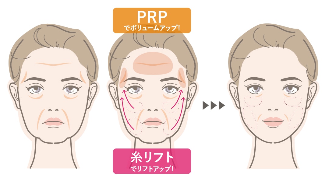 たるみもコケも同時に解決!