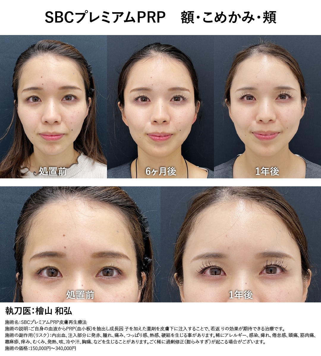安全に、半永続的な若返り