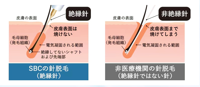 絶縁針とは？