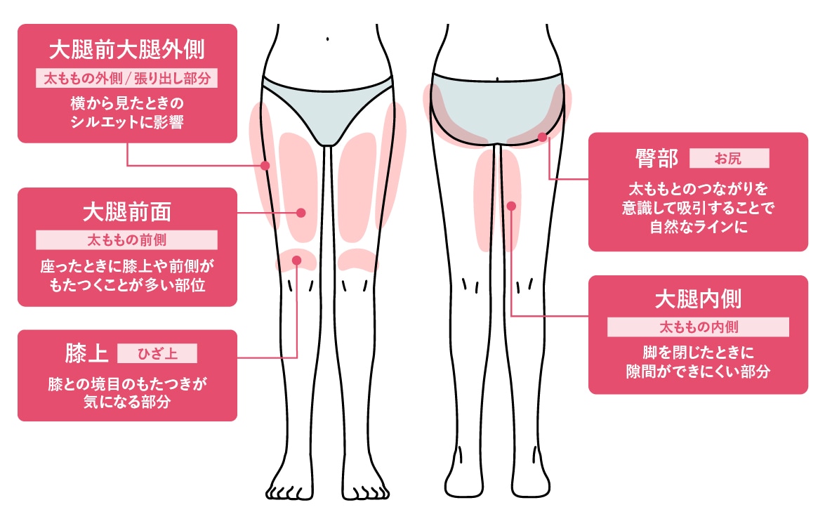太ももは大きく分けて、以下の部位があります