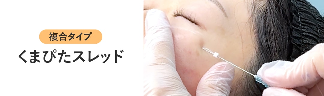 くまぴたスレッドってどんな治療？