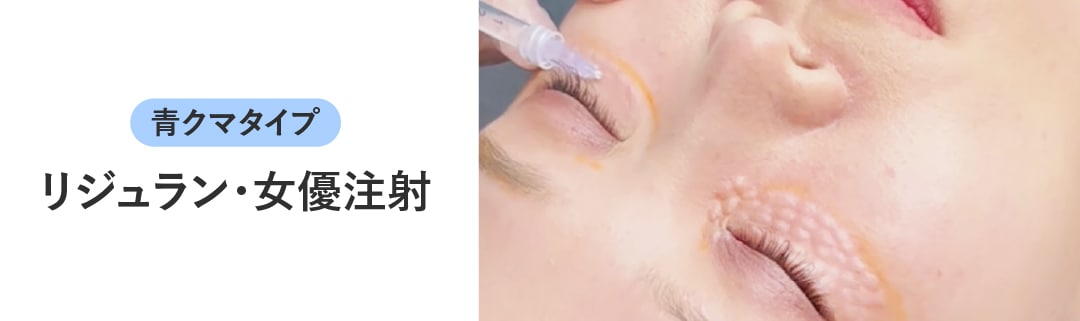 女優注射・リジュランはどんな治療？