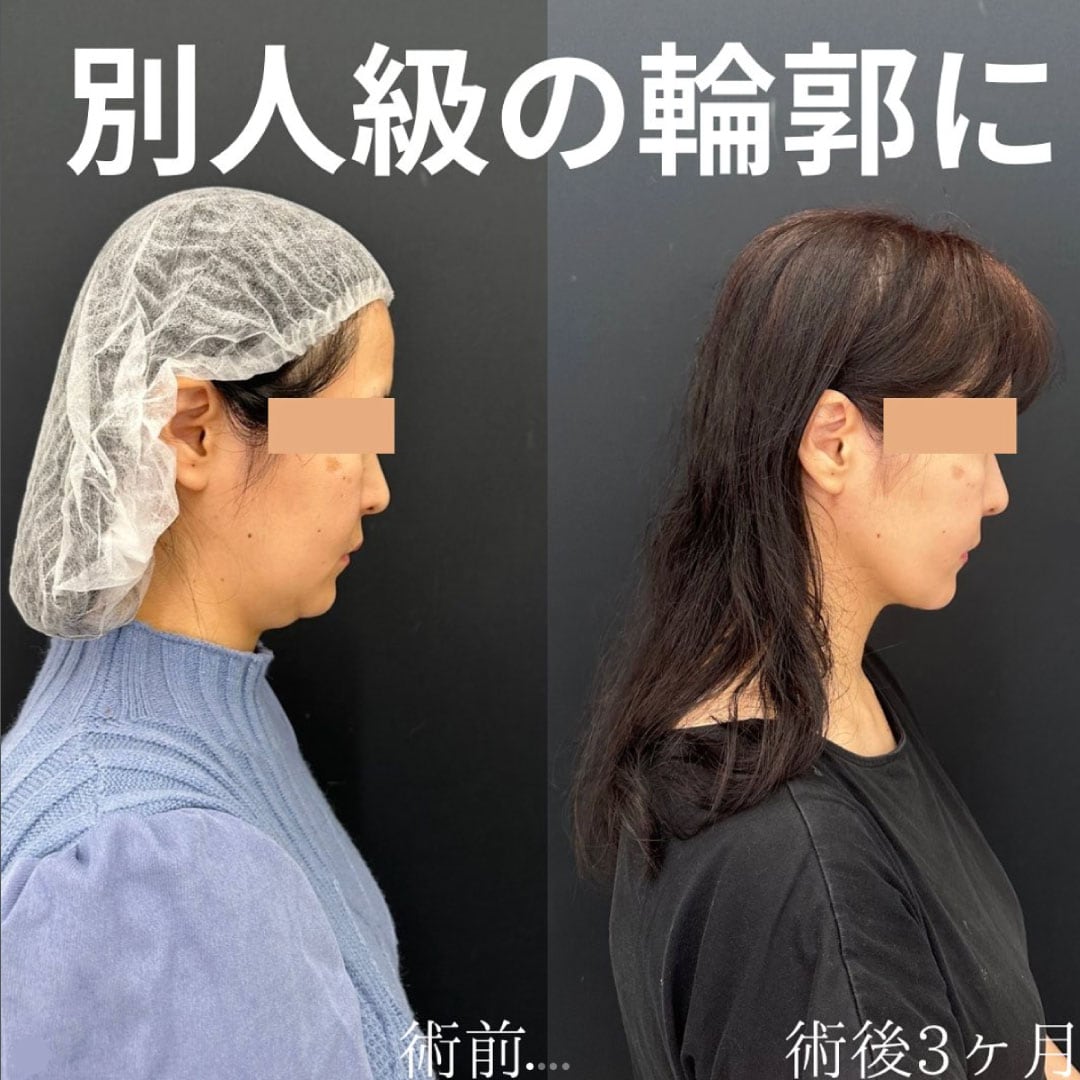 どの角度から見ても美しい輪郭デザイン