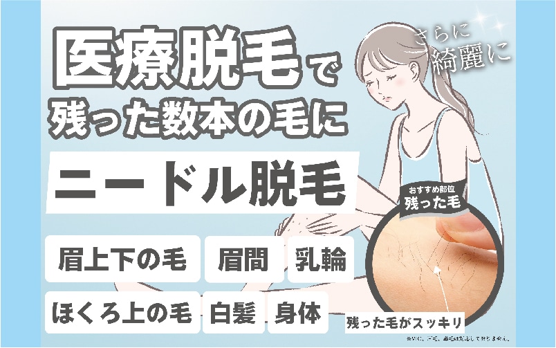 ニードル脱毛（医療針脱毛／絶縁針脱毛）