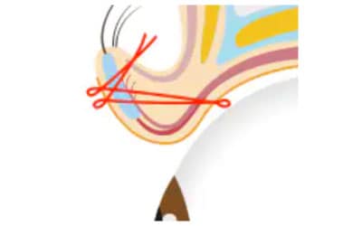 独自の方法を採用した治療法