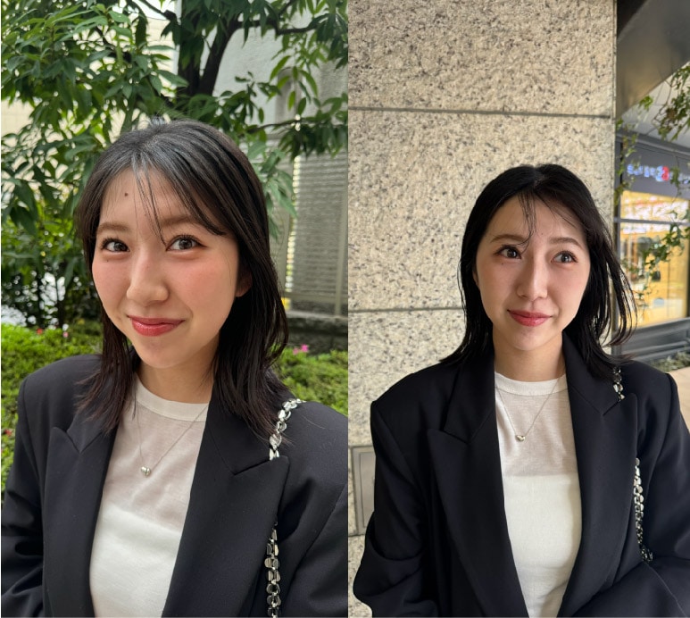 施術を受けて３ヶ月後
