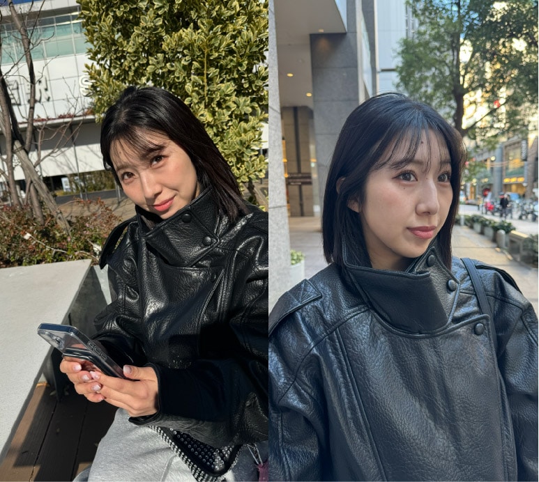 施術を受ける前