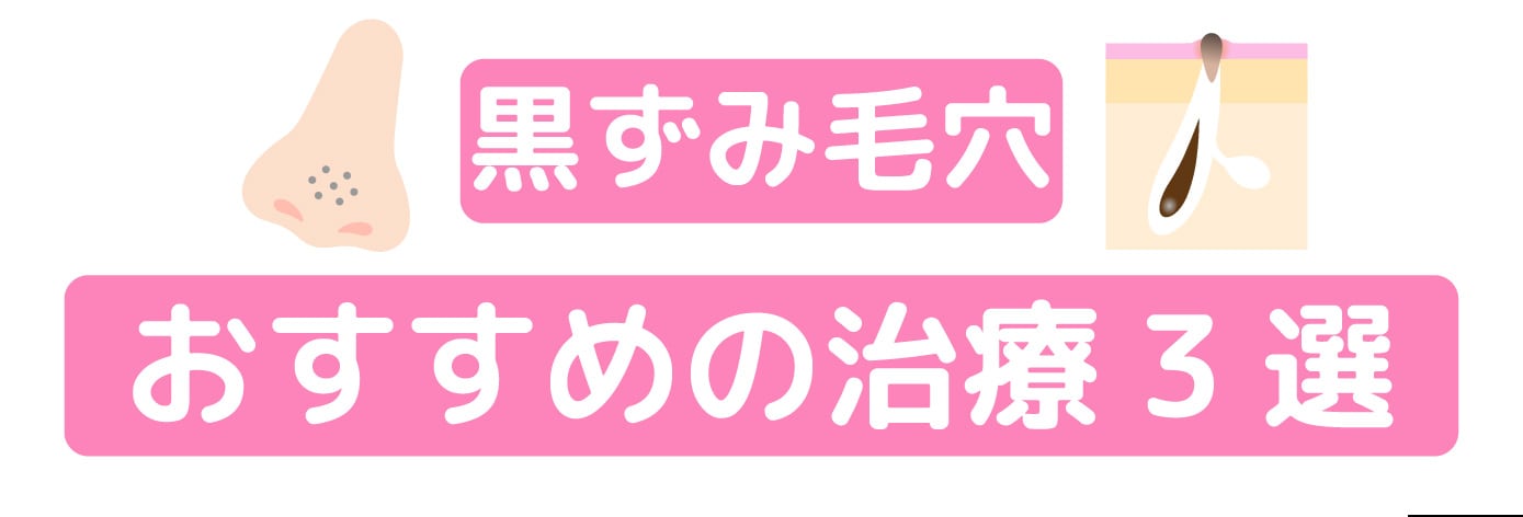 黒ずみ毛穴におすすめの治療3選