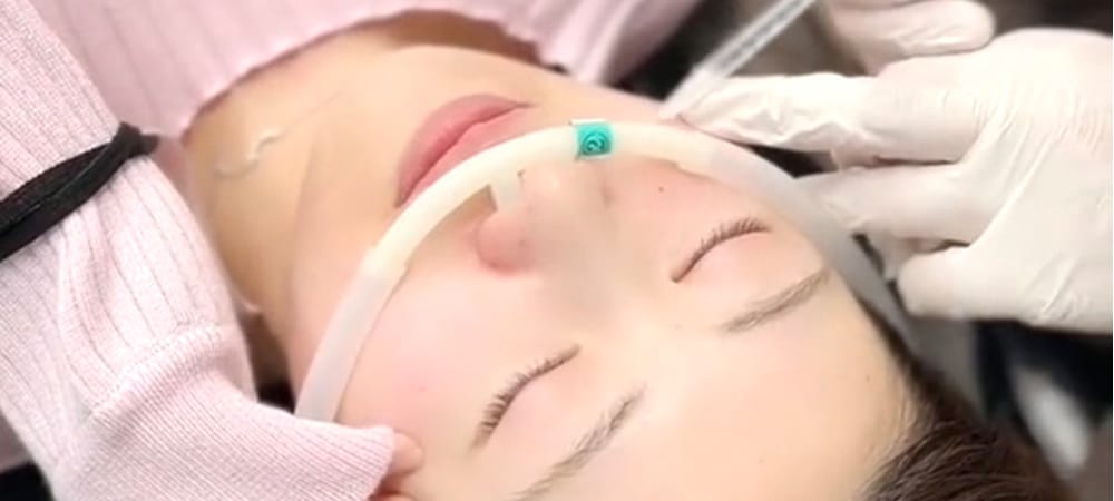 中顔面ボトックス(スキンボトックス)