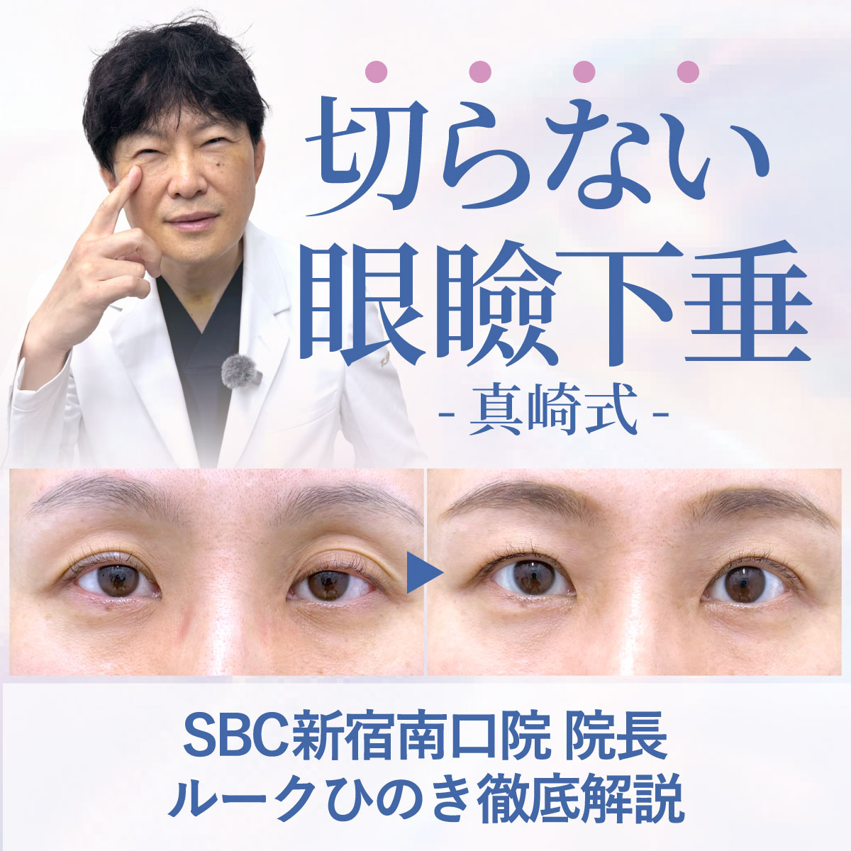 《新宿南口院》切らない眼瞼下垂 真崎式【従来の治療法との違い・効果】をルークひのきが解説