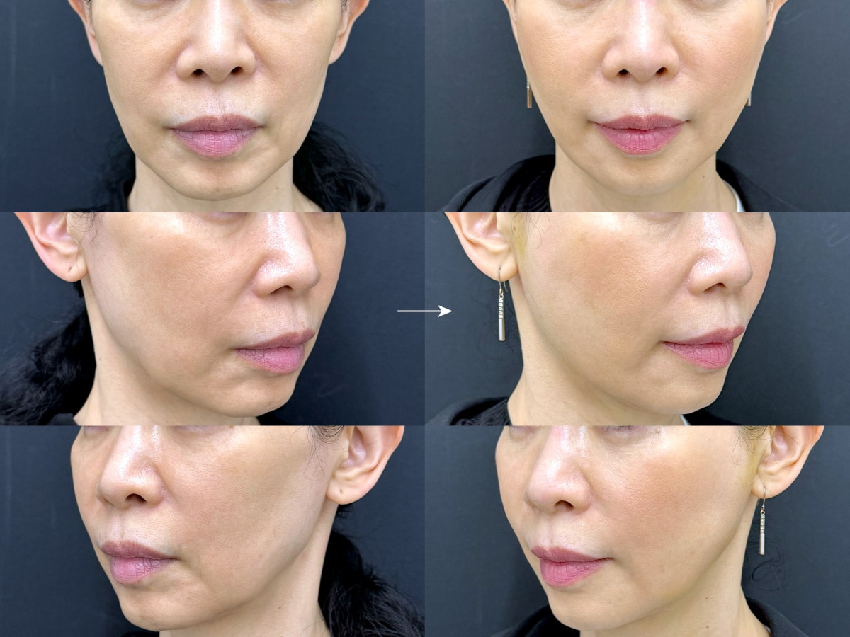 50代後半女性<br />
