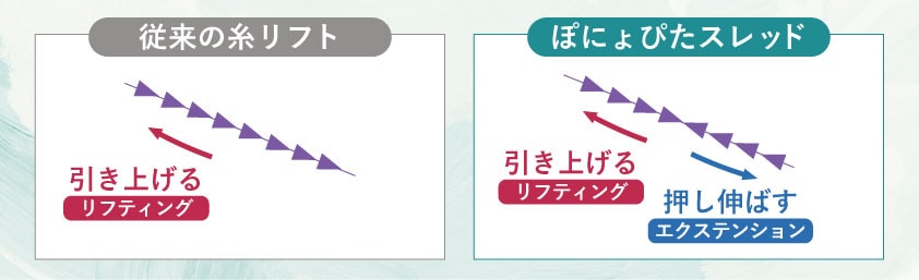 口横のポニョはどう整える？