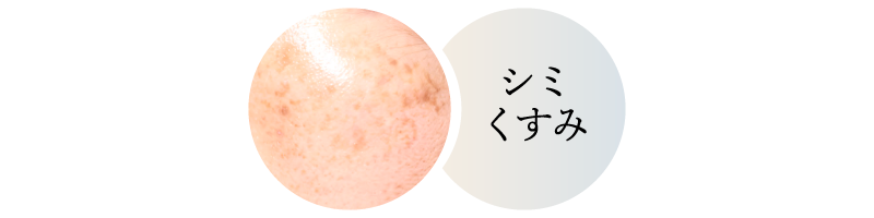 シミ取りレーザー