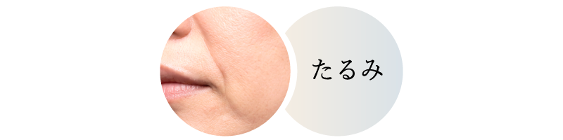 デンシティ