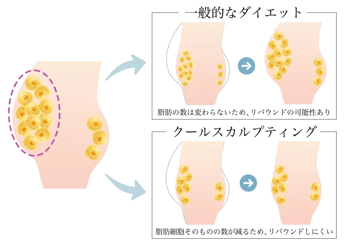 ①脂肪細胞の数を減らせる