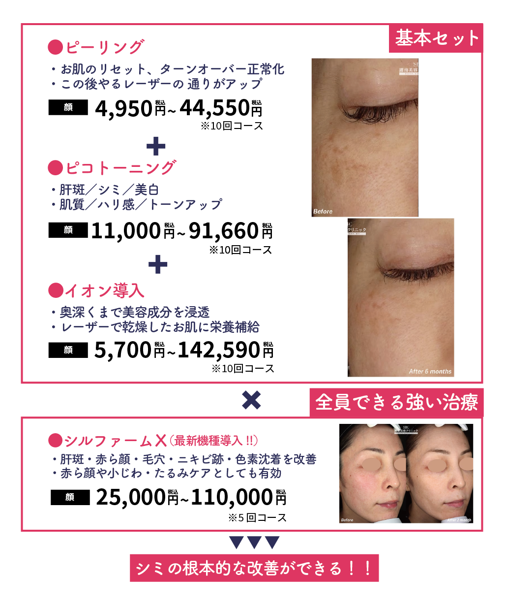 攻め治療と守り治療を組み合わせた例①