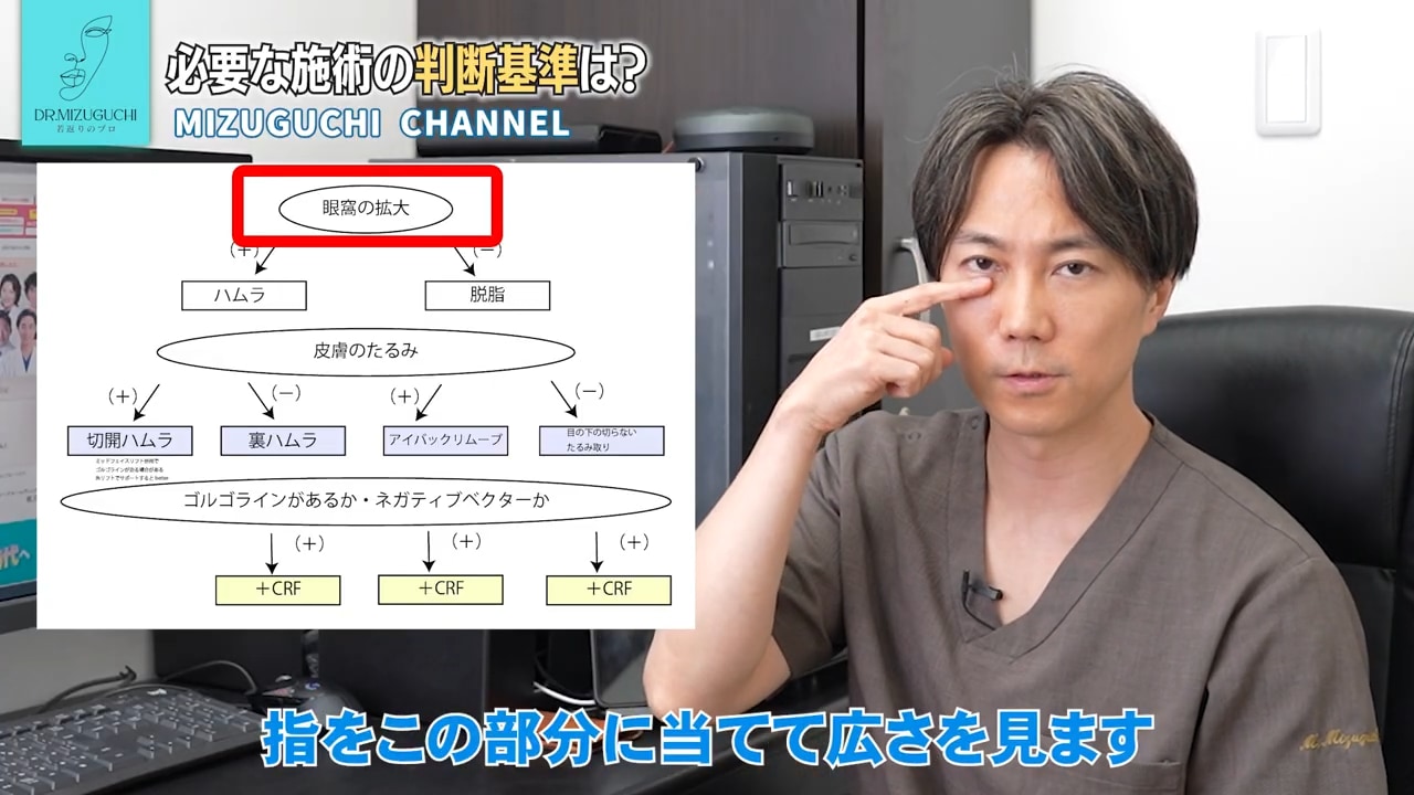 眼窩の拡大