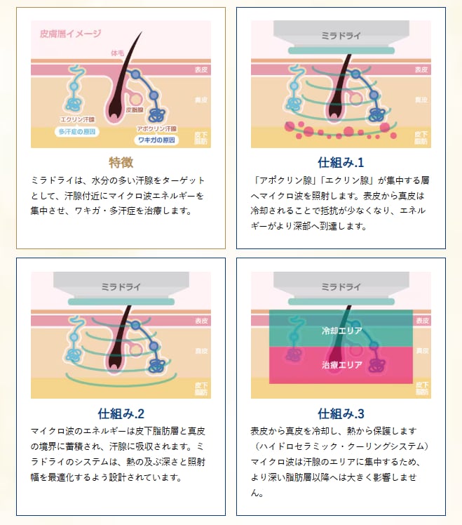 ミラドライの仕組み