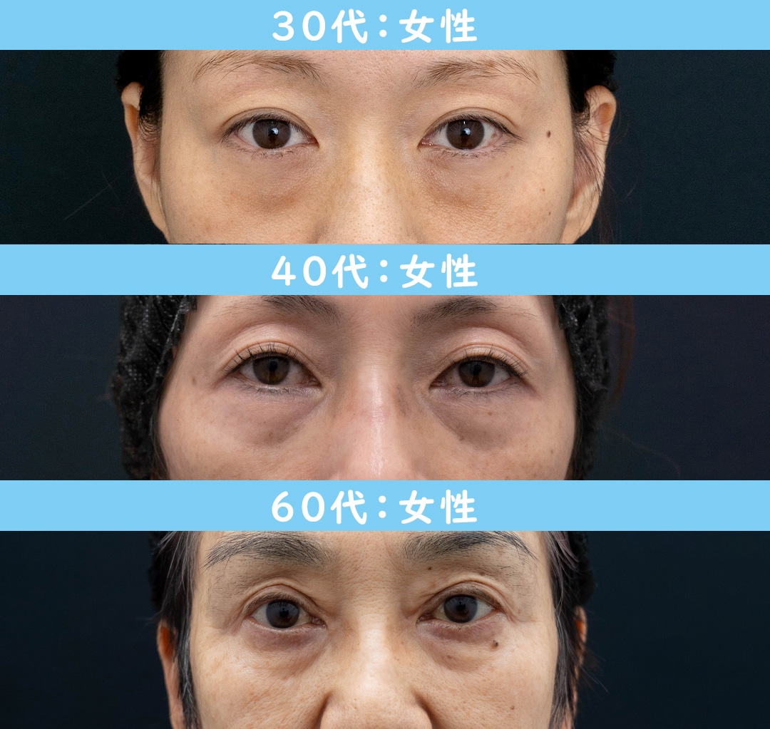 女性