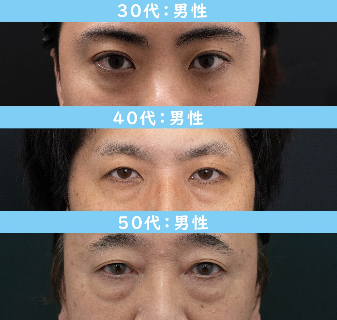 男性