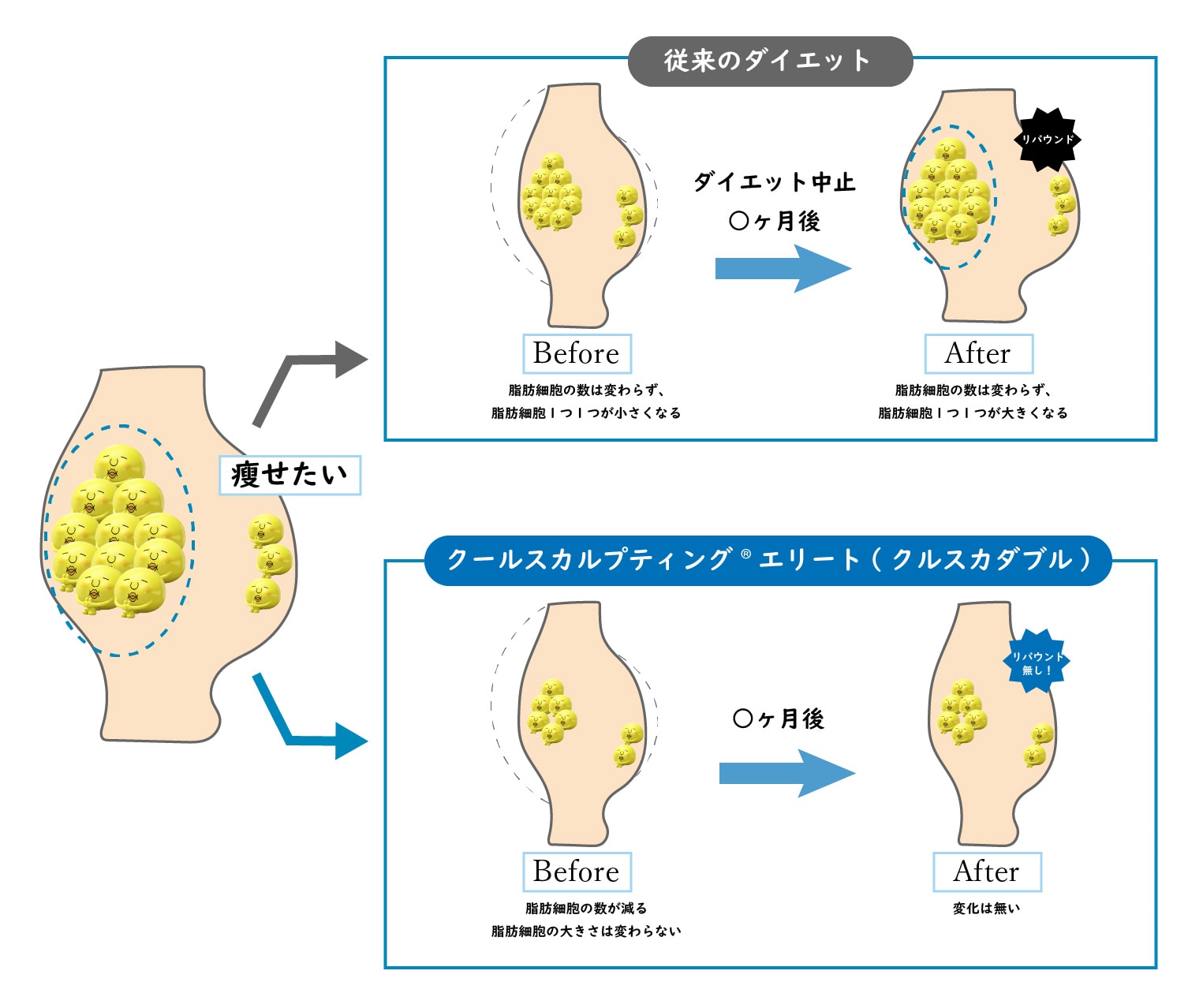POINT1