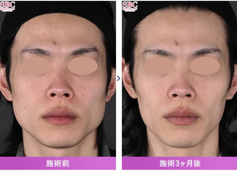 症例写真