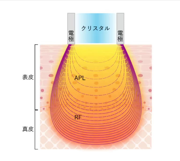 フォトRFとは