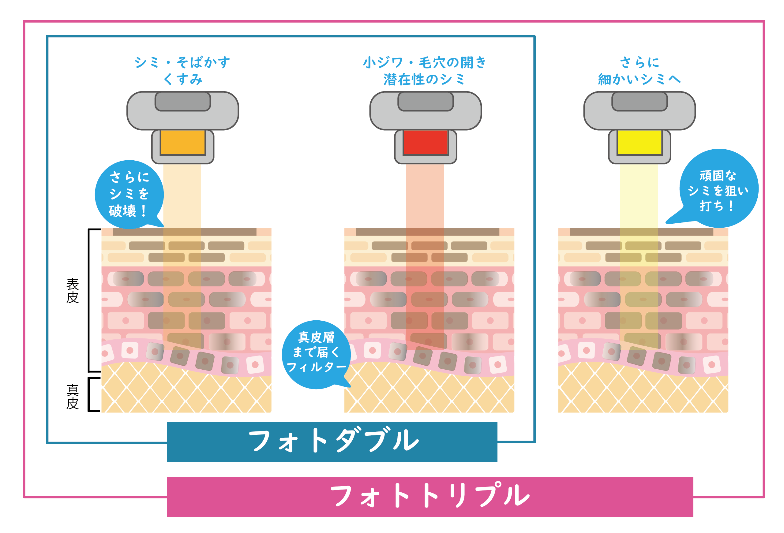２つの違い