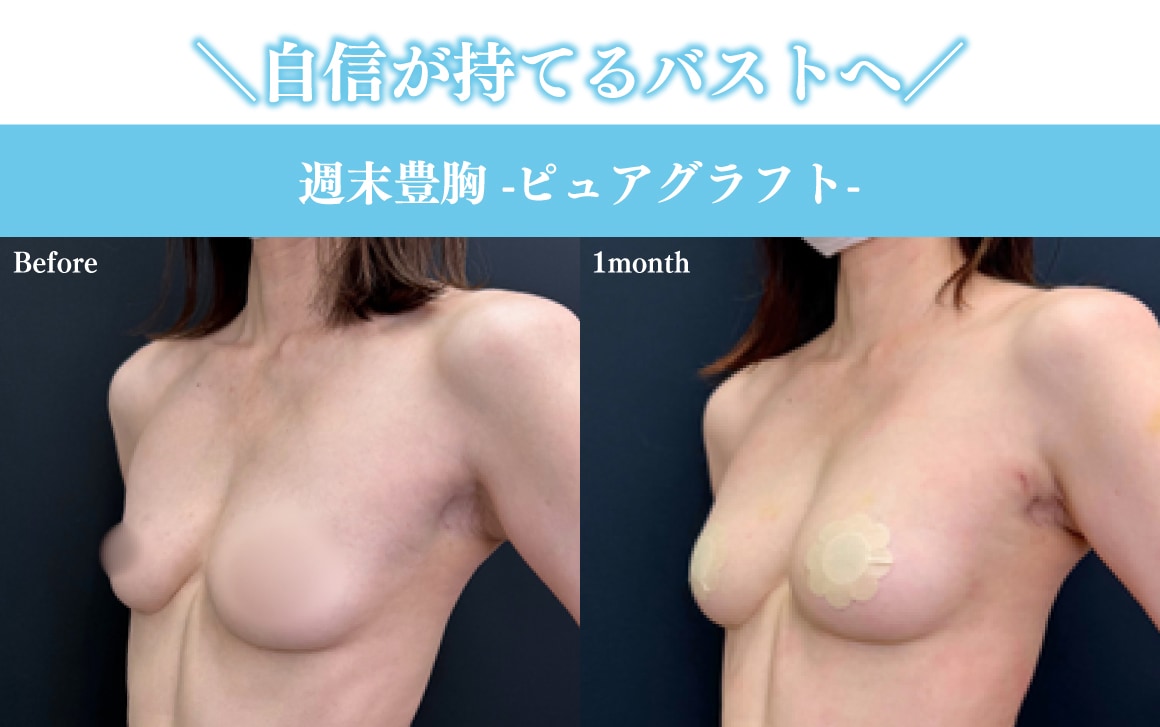 形成外科専門医の川口先生による豊胸