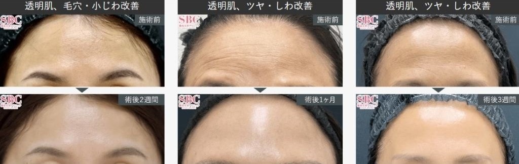 症例写真