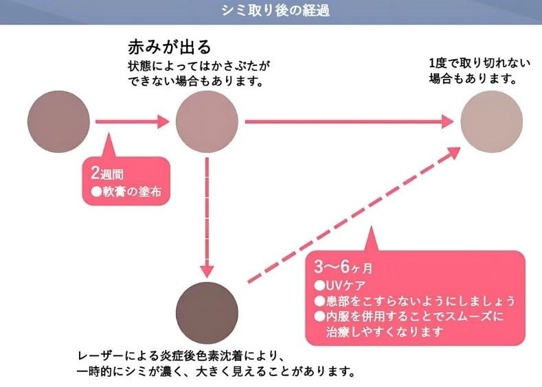メラニンを破壊!