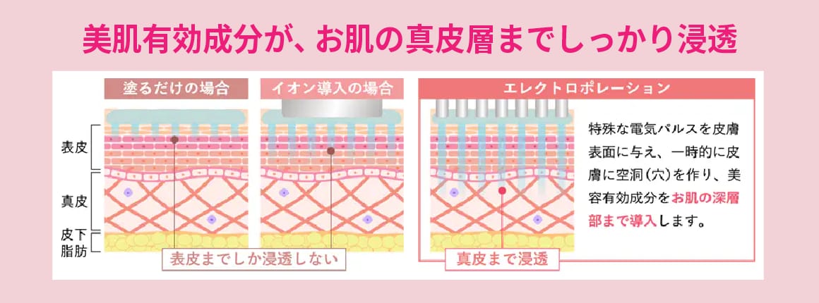 エレクトロポレーションなら