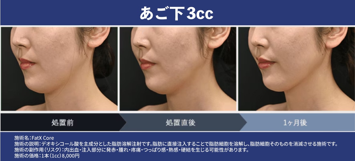 症例紹介