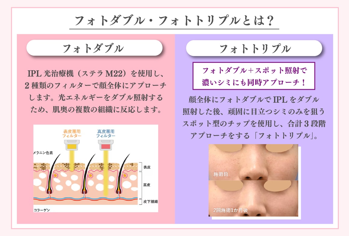フォトダブル・フォトトリプルとは？