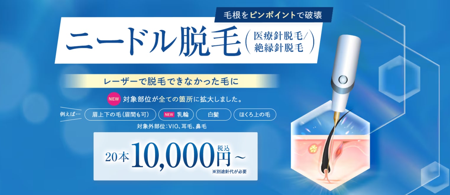 ニードル脱毛の特徴