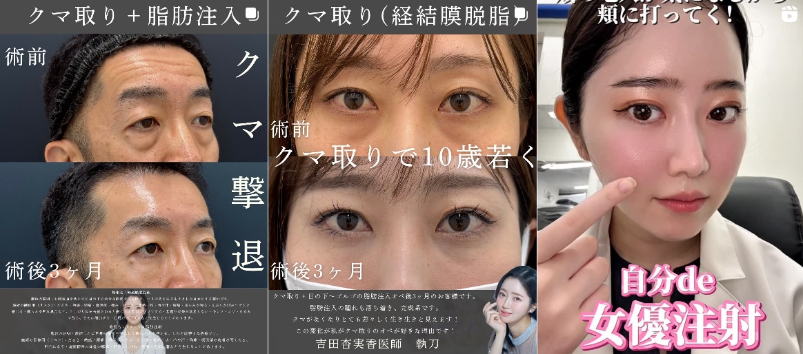 症例がたくさん載っているアカウントはこちら