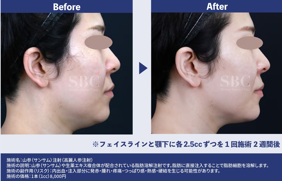 症例紹介