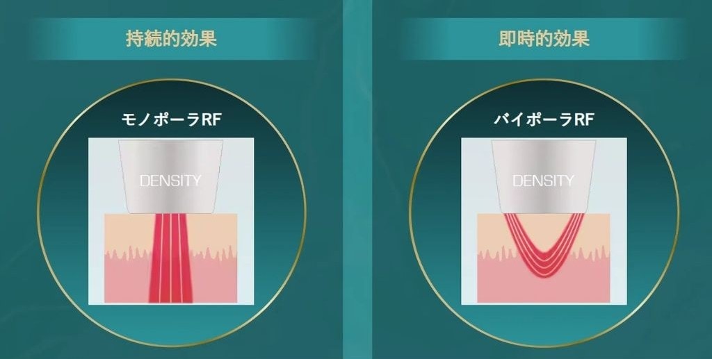 デンシティのここが凄い!