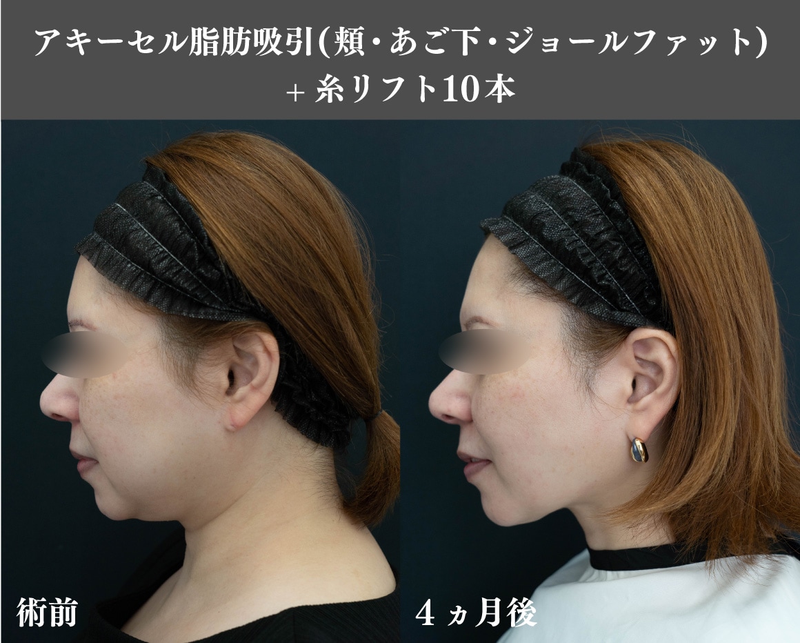顔の症例紹介
