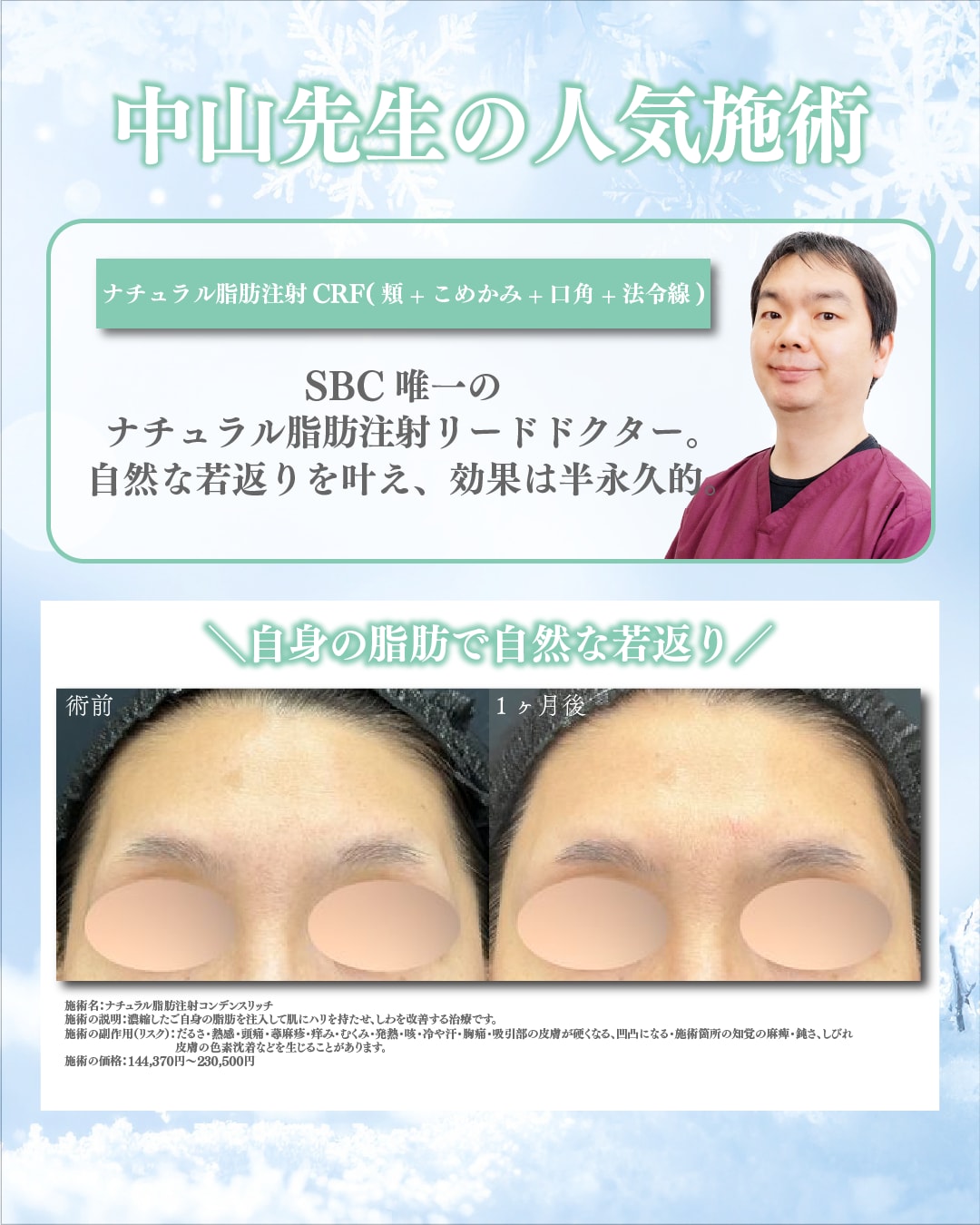 リードドクター・中山先生の脂肪注入症例