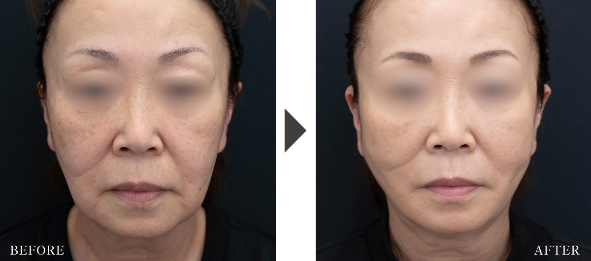 組み合わせ治療もおすすめ！