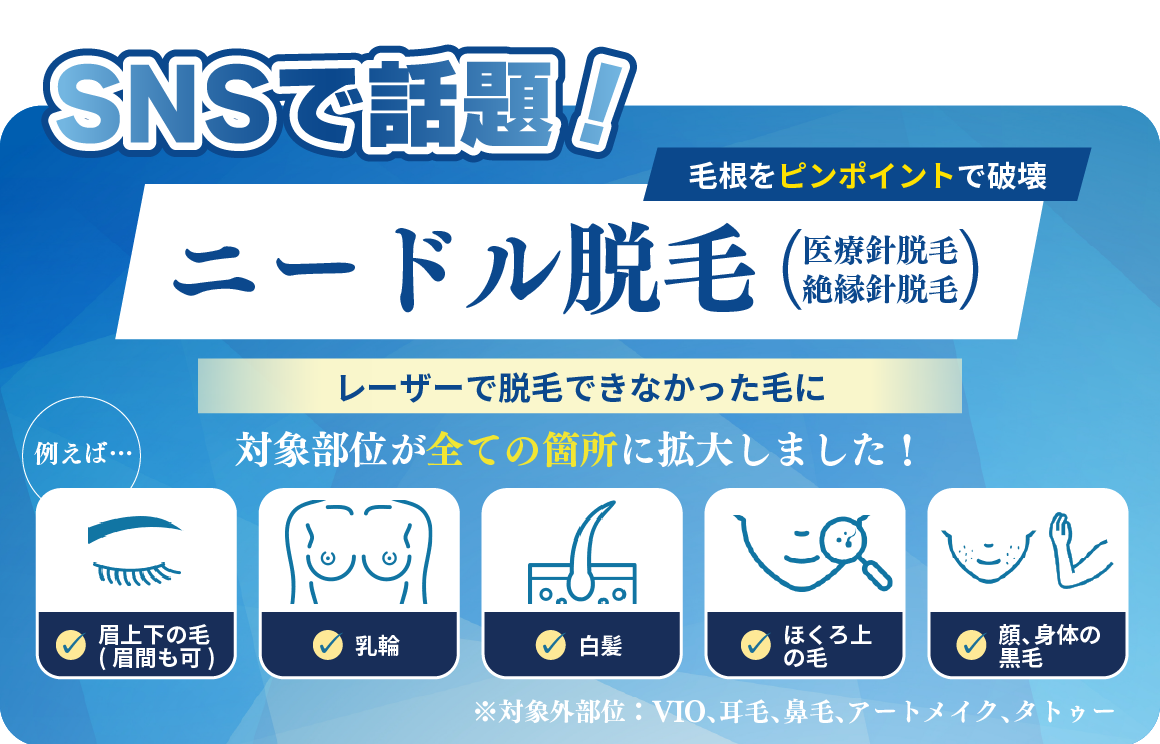 【SNSで話題!】何回脱毛してもなくならない毛に!仕上げのニードル脱毛✨