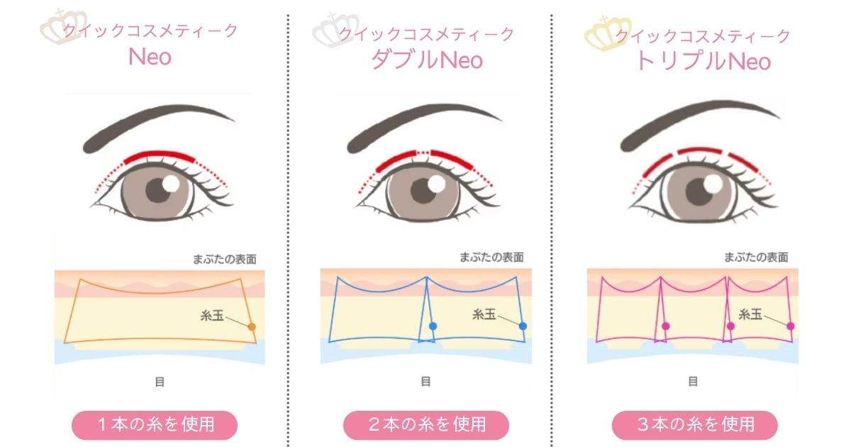 「シングル」「ダブル」「トリプル」の３パターン
