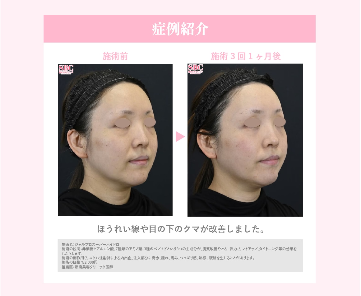 症例紹介
