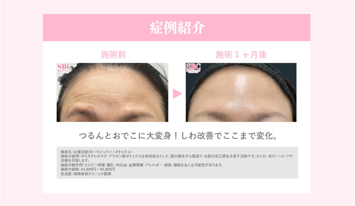 症例紹介