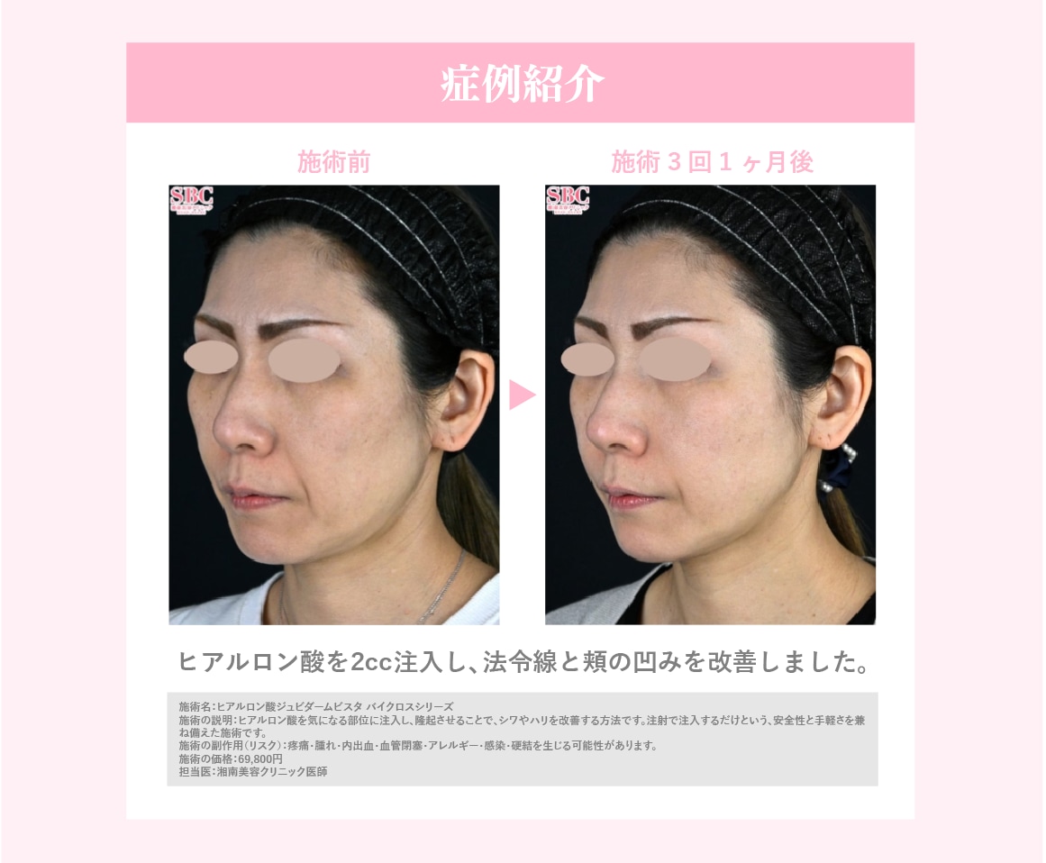症例紹介