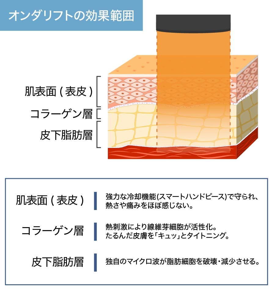 オンダリフトとは…？
